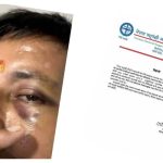 मेची शाखा उपाध्यक्ष कार्कीमाथि जेनजी बताउने समूहको आक्रमण, संघले गर्यो निन्दा